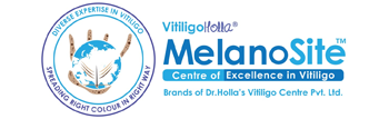 vitiligopedia-all-about-vitiligo